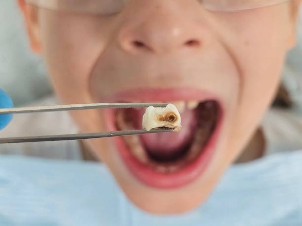 Best Emergency Broken Tooth Repair in Howards Grove, WI